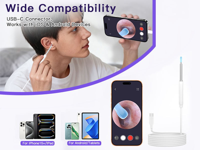Cross-Border New Version Smart Visual Ear Spoon - 1920P HD Direct Connection, Ear Cleaning & Care Kit
