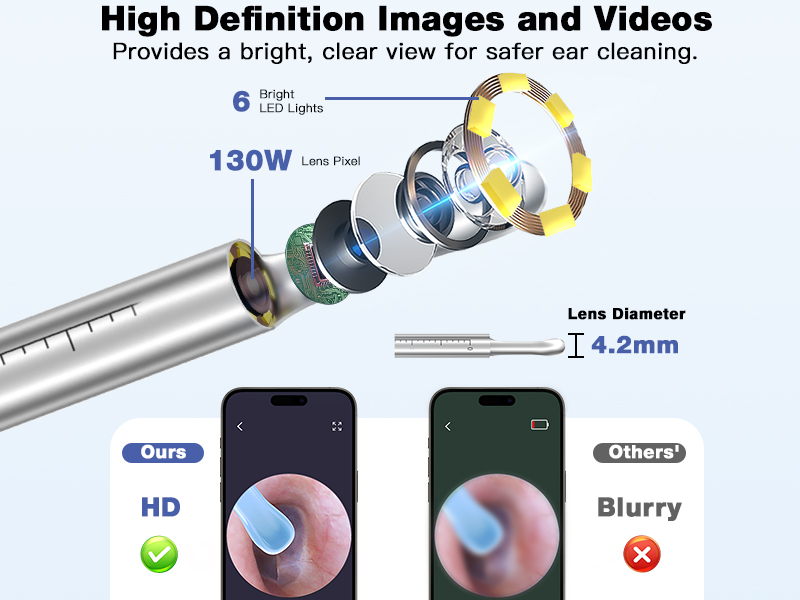 Cross-Border New Version Smart Visual Ear Spoon - 1920P HD Direct Connection, Ear Cleaning & Care Kit