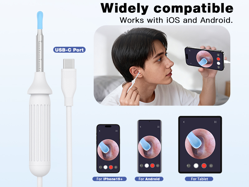 Cross-Border New Version Smart Visual Ear Spoon - 1920P HD Direct Connection, Ear Cleaning & Care Kit