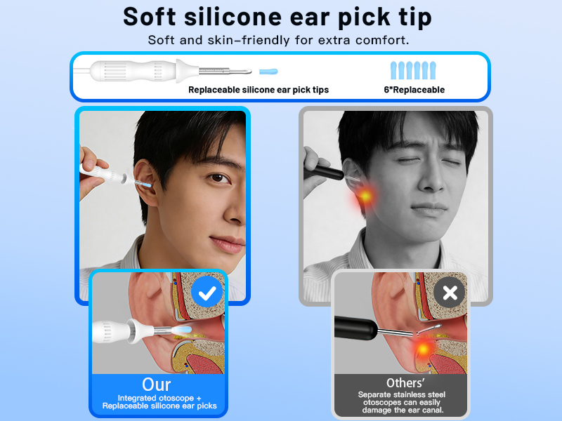 Cross-Border New Version Smart Visual Ear Spoon - 1920P HD Direct Connection, Ear Cleaning & Care Kit
